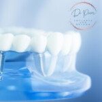 Group logo of DoctorPrem's Full Mouth Dental Campaign: Reimagine Your Smile and Wellness